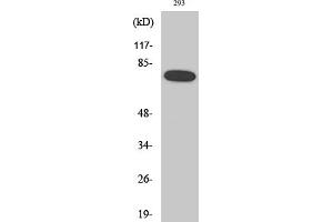 Western Blotting (WB) image for anti-Nuclear Factor-kB p65 (NFkBP65) (pSer468) antibody (ABIN5961221) (NF-kB p65 Antikörper  (pSer468))