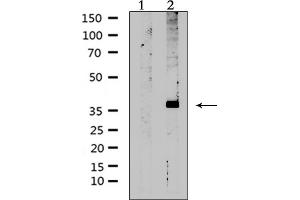 Western blot analysis of extracts from rat muscle, using AVPR2 Antibody.
