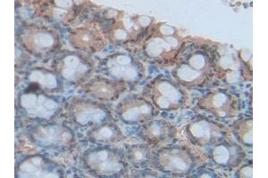 Immunohistochemistry (IHC) image for anti-S100 Calcium Binding Protein A6 (S100A6) (AA 1-89) antibody (ABIN7437005)