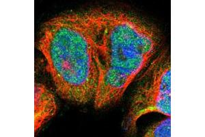 Immunofluorescent staining of A-431 cells with BLM polyclonal antibody  (Green) shows positivity in nucleus and cytoplasm. (BLM Antikörper)