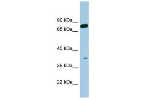 WB Suggested Anti-SDS Antibody Titration:  0. (serine Dehydratase Antikörper  (N-Term))