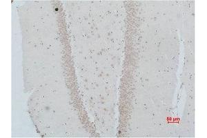 Immunohistochemical analysis of paraffin-embedded Rat Brain Tissue using NMBR Polyclonal Antibody. (NMBR Antikörper)