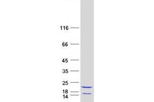 Western Blotting (WB) image for Eukaryotic Translation Initiation Factor 5A2 (EIF5A2) protein (Myc-DYKDDDDK Tag) (ABIN2720113)