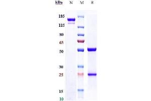 Anti- Human CD39( TTX-030) on SDS-PAGE under reducing (R) condition.