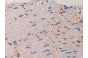 Immunohistochemistry (IHC) image for anti-Interleukin 11 Receptor, alpha (IL11RA) (AA 59-217) antibody (ABIN7437794)