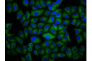 Immunofluorescence staining of Hela cells with ABIN7150914 at 1:100, counter-stained with DAPI. (Dysferlin Antikörper  (AA 105-278))