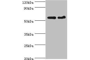 Western blot All lanes: CDK16 antibody at 5 μg/mL Lane 1: Mouse brain tissue Lane 2: Mouse small intestine tissue Secondary Goat polyclonal to rabbit IgG at 1/10000 dilution Predicted band size: 56, 64, 57 kDa Observed band size: 56 kDa (CDK16 Antikörper  (AA 277-496))