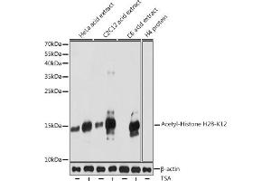 Western blot analysis of extracts of various cell lines, using Acetyl-Histone H2B-K12 antibody (ABIN7267731) at 1:1000 dilution. (Histone H2B Antikörper  (acLys12))
