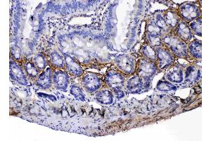 Immunohistochemistry (IHC) image for anti-Periostin (POSTN) (AA 577-810) antibody (ABIN5519054)