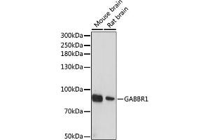 Western blot analysis of extracts of various cell lines, using G antibody (ABIN6131686, ABIN6140882, ABIN6140883 and ABIN6214785) at 1:1000 dilution. (GABBR1 Antikörper  (AA 200-460))