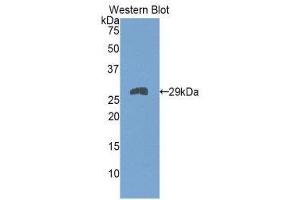 Western Blotting (WB) image for anti-Slow Skeletal Troponin T (TNNT1) (AA 1-228) antibody (ABIN1860819) (TNNT1 Antikörper  (AA 1-228))