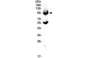 Western blot testing of mouse lung tissue lysate with CD105 antibody at 0. (Endoglin Antikörper)