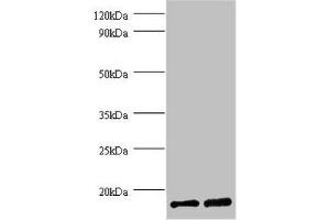 Western blot All lanes: FKBP1A antibody at 2 μg/mL Lane 1: EC109 whole cell lysate Lane 2: 293T whole cell lysate Secondary Goat polyclonal to rabbit IgG at 1/15000 dilution Predicted band size: 12 kDa Observed band size: 12 kDa (FKBP1A Antikörper  (AA 2-103))