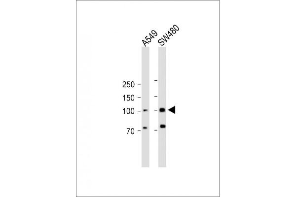 RASGRP1 Antikörper  (AA 495-521)