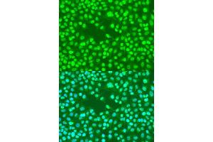 Immunofluorescence (IF) image for anti-RAD23 Homolog B (RAD23B) (AA 50-150) antibody (ABIN6146632)