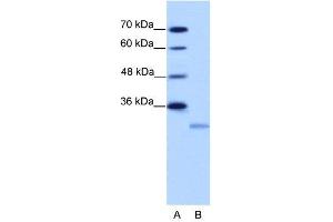 WB Suggested Anti-EIF4E2  Antibody Titration: 2. (EIF4E2 Antikörper  (N-Term))