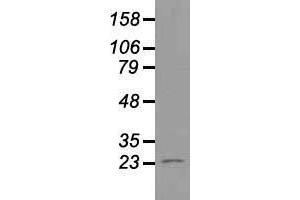 Western blot analysis of 35 µg of cell extracts from human Liver carcinoma (HepG2) cells using anti-NEUROG1 antibody. (Neurogenin 1 Antikörper)