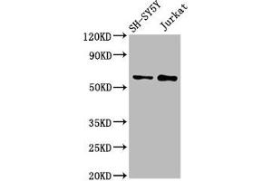 Western Blot Positive WB detected in: SH-SY5Y whole cell lysate, Jurkat whole cell lysate All lanes: MGAT4B antibody at 3 μg/mL Secondary Goat polyclonal to rabbit IgG at 1/50000 dilution Predicted band size: 64, 65 kDa Observed band size: 64 kDa (MGAT4B Antikörper  (AA 380-522))