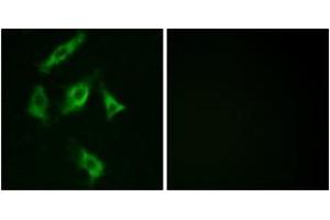 Immunofluorescence analysis of COS7 cells, using Stathmin 1 (Ab-15) Antibody. (Stathmin 1 Antikörper  (AA 5-54))