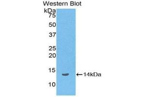 Western Blotting (WB) image for anti-Lipotropin, beta - (AA 179-267) antibody (ABIN1858144) (Lipotropin, beta - (AA 179-267) Antikörper)