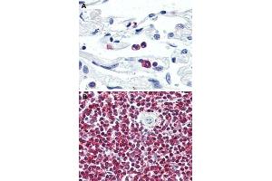 Immunohistochemical (Formalin/PFA-fixed paraffin-embedded sections) staining in human neutrophils (A) and human spleen (B) with LGR6 polyclonal antibody . (LGR6 Antikörper  (Internal Region))