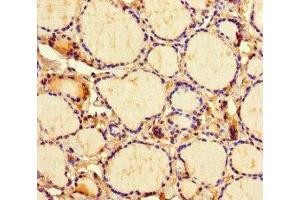 Immunohistochemistry of paraffin-embedded human thyroid tissue using ABIN7158468 at dilution of 1:100 (ICE1 (AA 1213-1505) Antikörper)