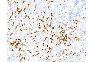 Immunohistochemistry (IHC) image for anti-Mannose Receptor, C Type 1 (MRC1) (AA 1406-1456) antibody (ABIN7455101)