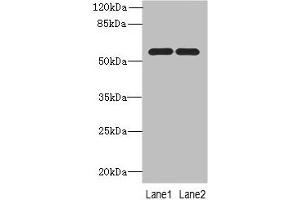 PSMD12 Antikörper  (Regulatory Subunit 12)