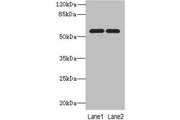 PSMD12 Antikörper  (Regulatory Subunit 12)