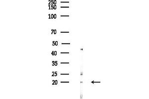 anti-H1 Histone Family, Member 0 (H1F0) (Internal Region) antibody