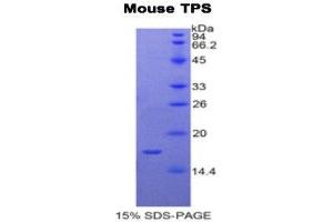 SDS-PAGE (SDS) image for Tryptase alpha/beta 1 (TPSAB1) (AA 149-273) protein (His tag) (ABIN2122276)