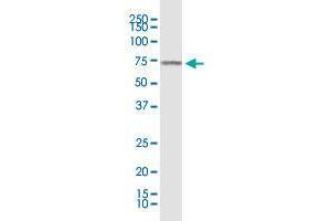 KLF11 monoclonal antibody (M03), clone 10D8. (KLF11 Antikörper  (AA 404-512))