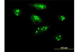 Immunofluorescence of purified MaxPab antibody to MKI67IP on HeLa cell. (NIFK Antikörper  (AA 1-293))
