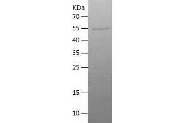 SH3RF1 Protein (AA 583-879) (His-IF2DI Tag)