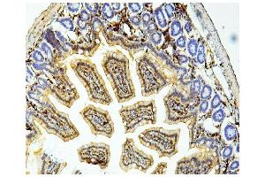 IHC analysis of Galectin 3/LGALS3 using anti Galectin 3/LGALS3 antibody (ABIN6719486). (Galectin 3 Antikörper  (AA 139-250))