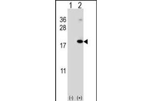 Western blot analysis of RNF5 (arrow) using rabbit polyclonal RNF5 Antibody (N-term) (ABIN652548 and ABIN2842368). (RNF5 Antikörper  (AA 1-30))