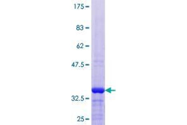 ASXL1 Protein (AA 1-84) (GST tag)