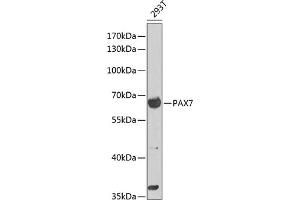 Western blot analysis of extracts of 293T cells, using P antibody (ABIN6132463, ABIN6145262, ABIN6145264 and ABIN6216484) at 1:1000 dilution. (PAX7 Antikörper  (AA 289-518))