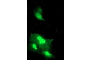 Anti-DTNB mouse monoclonal antibody (ABIN2455578) immunofluorescent staining of COS7 cells transiently transfected by pCMV6-ENTRY DTNB (RC203798).