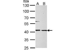 WB Image MPI antibody detects MPI protein by Western blot analysis. (MPI Antikörper)
