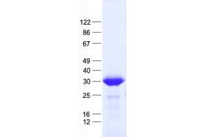 Validation with Western Blot (RANBP1 Protein (His tag))