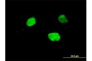 Immunofluorescence of monoclonal antibody to IRX5 on HeLa cell. (IRX5 Antikörper  (AA 204-264))