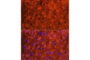 Immunofluorescence analysis of mouse brain using CDK6 antibody (ABIN7266595) at dilution of 1:100. (CDK6 Antikörper  (AA 1-326))