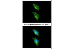 ICC/IF Image Immunofluorescence analysis of methanol-fixed HeLa, using GPR82, antibody at 1:200 dilution. (GPR82 Antikörper)