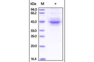 Human TIGIT, Fc Tag on SDS-PAGE under reducing (R) condition. (TIGIT Protein (AA 22-141) (Fc Tag))