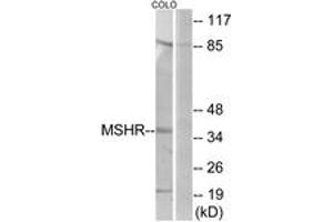 Western blot analysis of extracts from COLO205 cells, using MSHR Antibody.