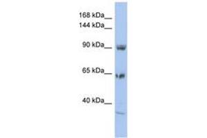 Image no. 1 for anti-Two Pore Segment Channel 1 (TPCN1) (AA 71-120) antibody (ABIN6742558)