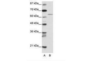Image no. 1 for anti-Regulatory Factor X 5 (RFX5) (N-Term) antibody (ABIN203226)