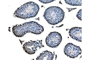 IHC analysis of CBX2 using anti-CBX2 antibody (ABIN7599466).