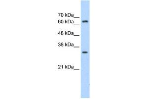 WB Suggested Anti-MTA2 Antibody Titration:  1. (MTA2 Antikörper  (C-Term))
